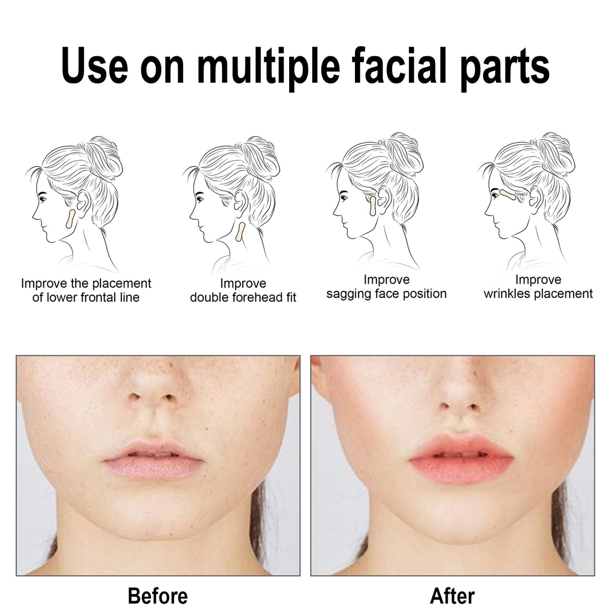 Facial Lifting Patch, Lift Face Double Chin V Face Melon Seed Face Invisible Lifting Patch