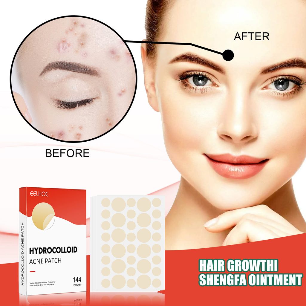 Hydrocolloid Acne Patch Face Invisible Makeup Closed Mouth Acne Clear Acne Waterproof Breathable Facial Treatment