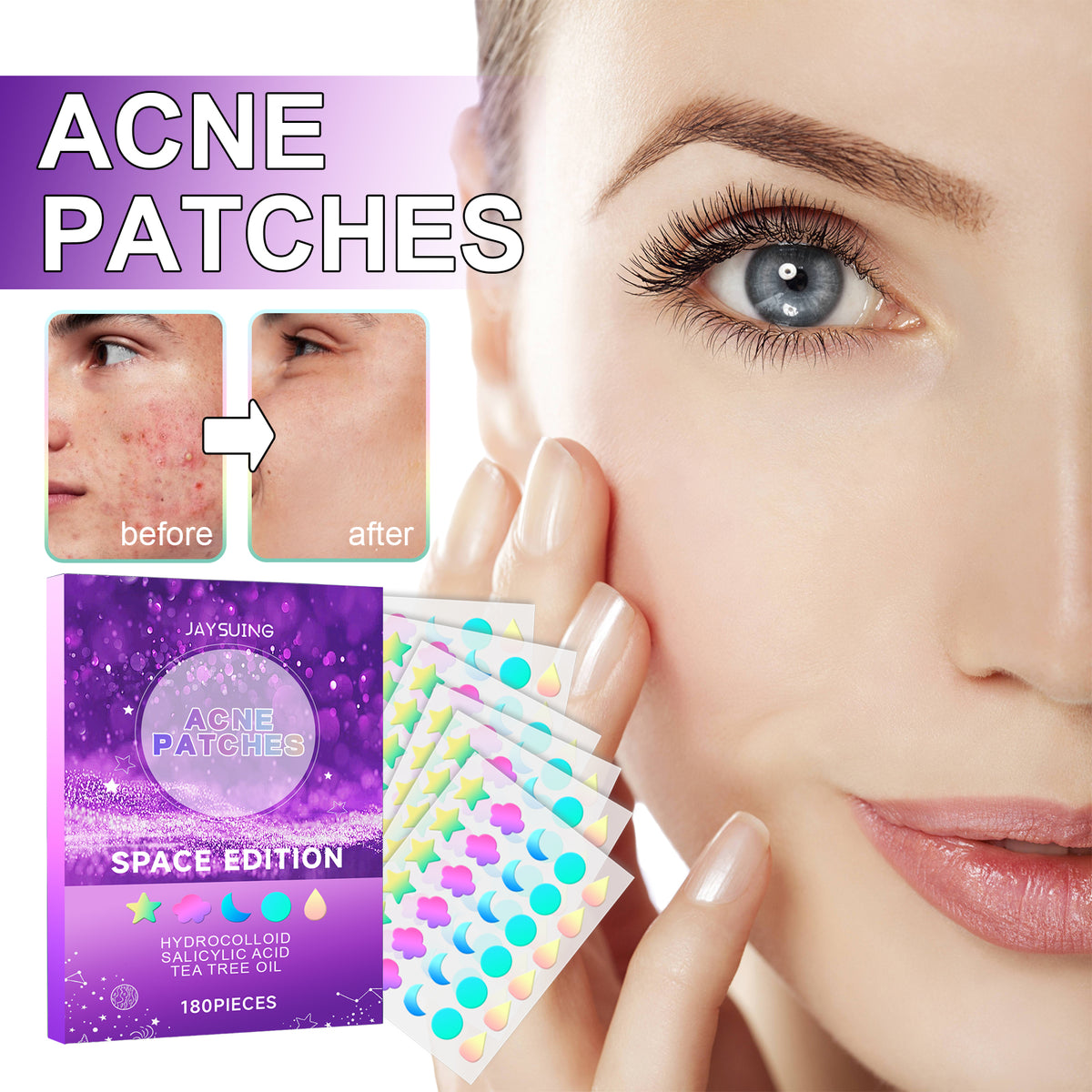 Acne Patches Lighten Facial Acne, Close Mouth Care And Balance Delicate Skin Pores Patch